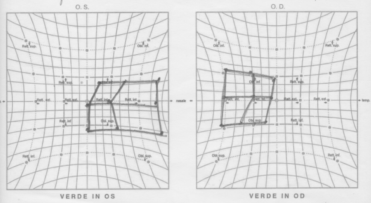 schema di HESS VI nc odx